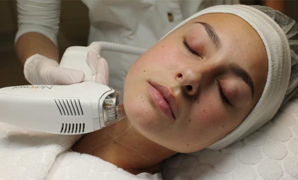 Sentient Tixel skin resurfacing — clinical aesthetic treatment